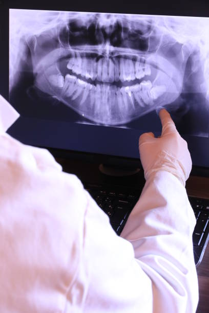 Best Emergency Dental Extractions in Harrison, NJ