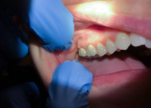 Best Emergency Dental Services for Seniors in Harrison, NJ