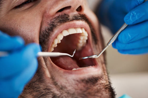 Best Emergency Dental Care for Abscessed Tooth in Harrison, NJ